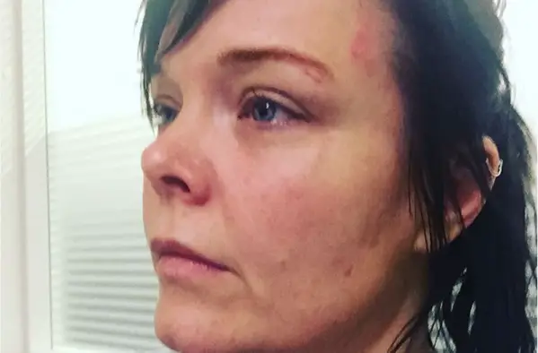 Ex-NIGHTWISH Singer Anette Olzon ‘Got Beaten Down And Robbed’ Earlier Today