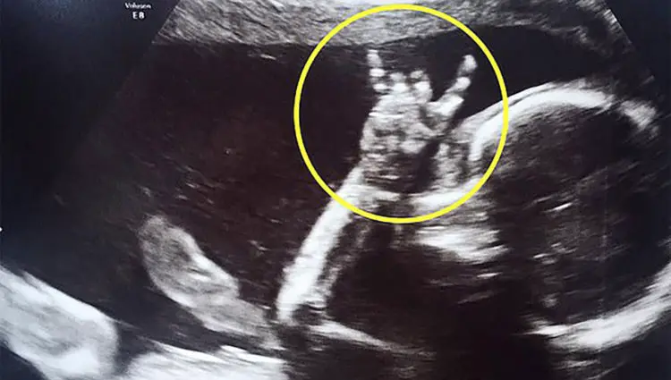 Baby Throws Horns