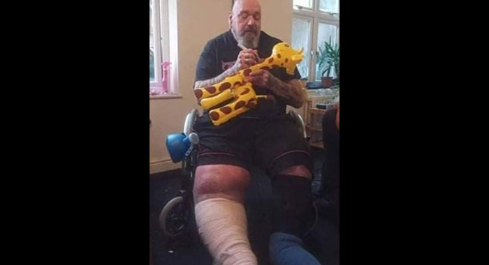 Paul Di'Anno Leg