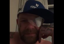 Ivan Moody Eye Injured