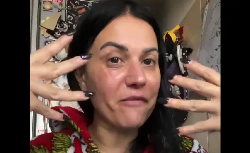 Cristina Scabbia Burned Face